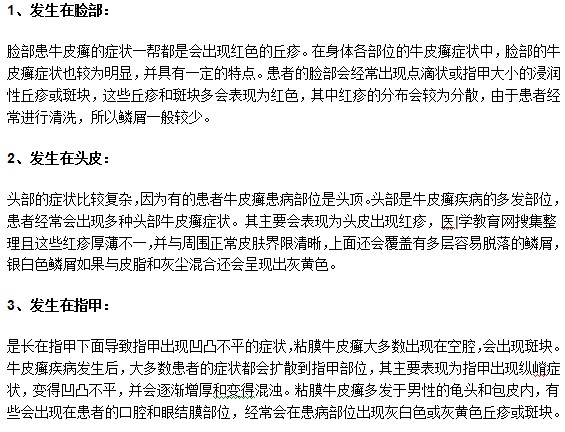 牛皮癬疾病常見的發(fā)病部位有哪些？